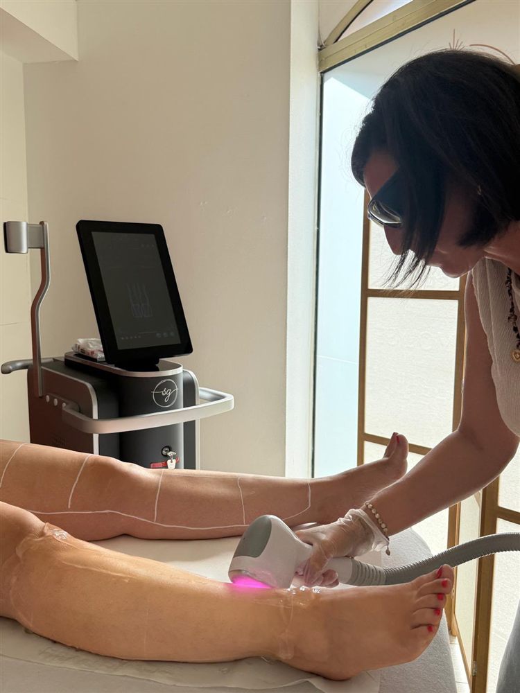 Séance d'épilation laser chez DS LASER