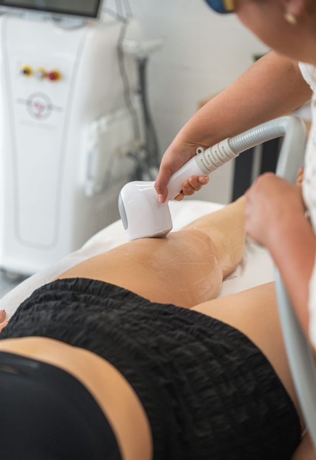 Épilation laser durable pour les femmes à Trégunc – DS LASER