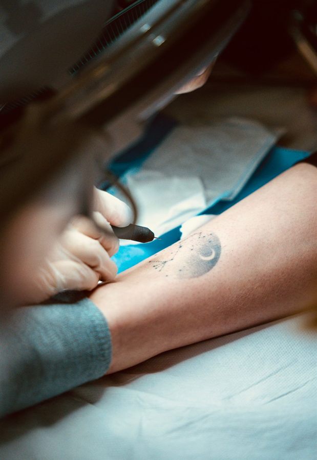 Thermolyse sur zone tatouée à Trégunc – DS LASER