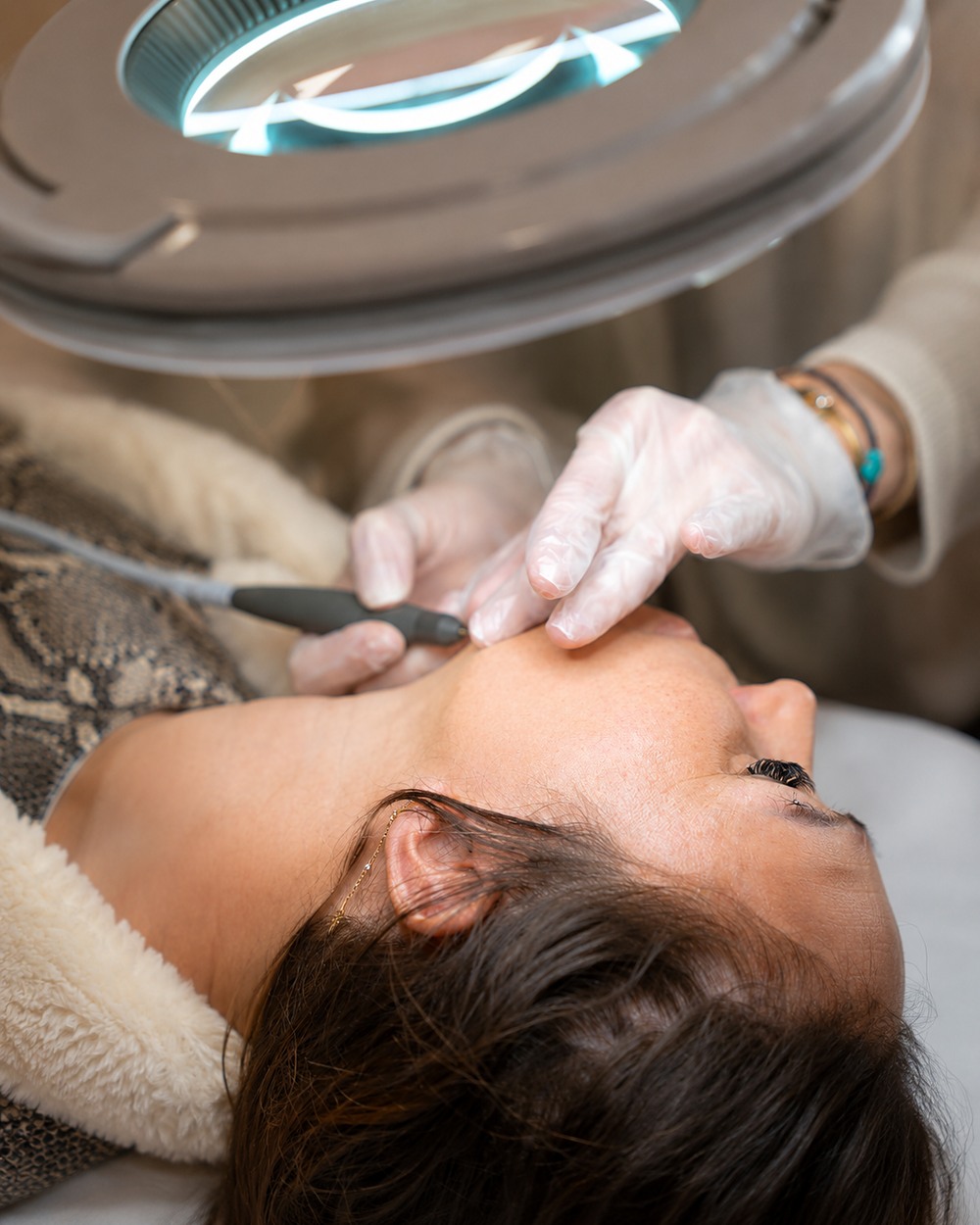 Épilation définitive par thermolyse à Trégunc – DS LASER